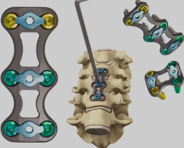 Diseño CAD/CAM